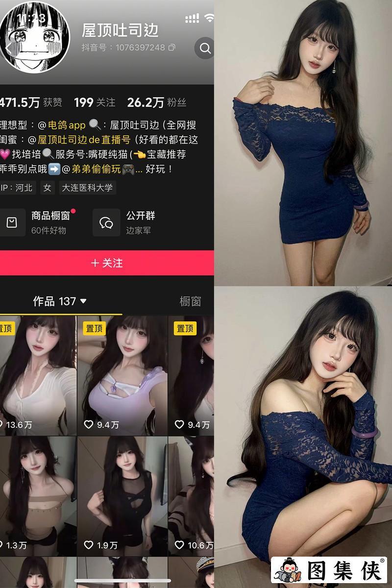 屋顶吐司边 – 微密圈/岛遇等写真&视频合集【持续更新中】