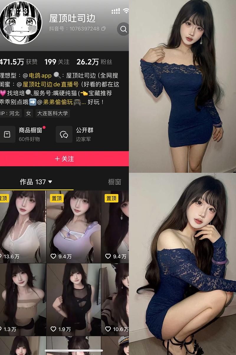 屋顶吐司边 – 微密圈/岛遇等写真&视频合集【持续更新中】